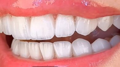 مركز الدكتور أنس عبدرالرحمن لزراعة الأسنان ورسم أبتسامة هوليود