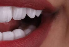 تركيبات الزيركون تختلف جودتها من عيادة أسنان لعيادة أخرى ما هي العوامل التي تسبب اختلاف الجودة والأسعار بين مراكز الأسنان وعيادات الأسنان