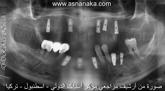 زراعه عشر زراعات اقتصاديه